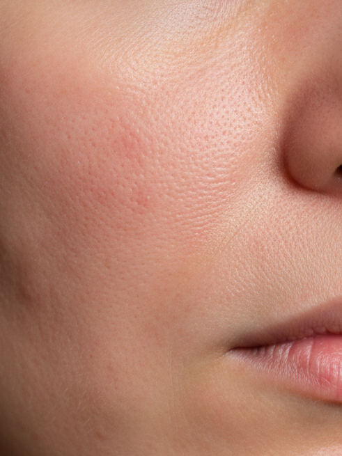 Female skin care treatment close-up