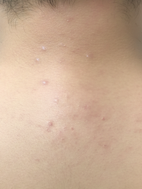 Clear and smooth male skin appearance