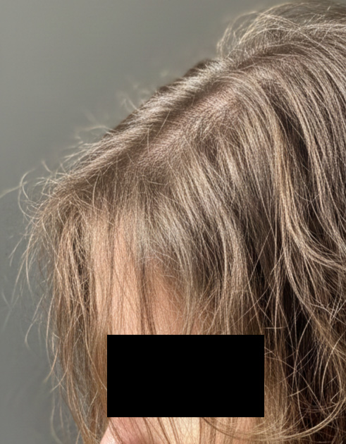 Women hair repair and nourishment concept