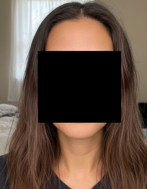 Female hair growth and strengthening treatment
