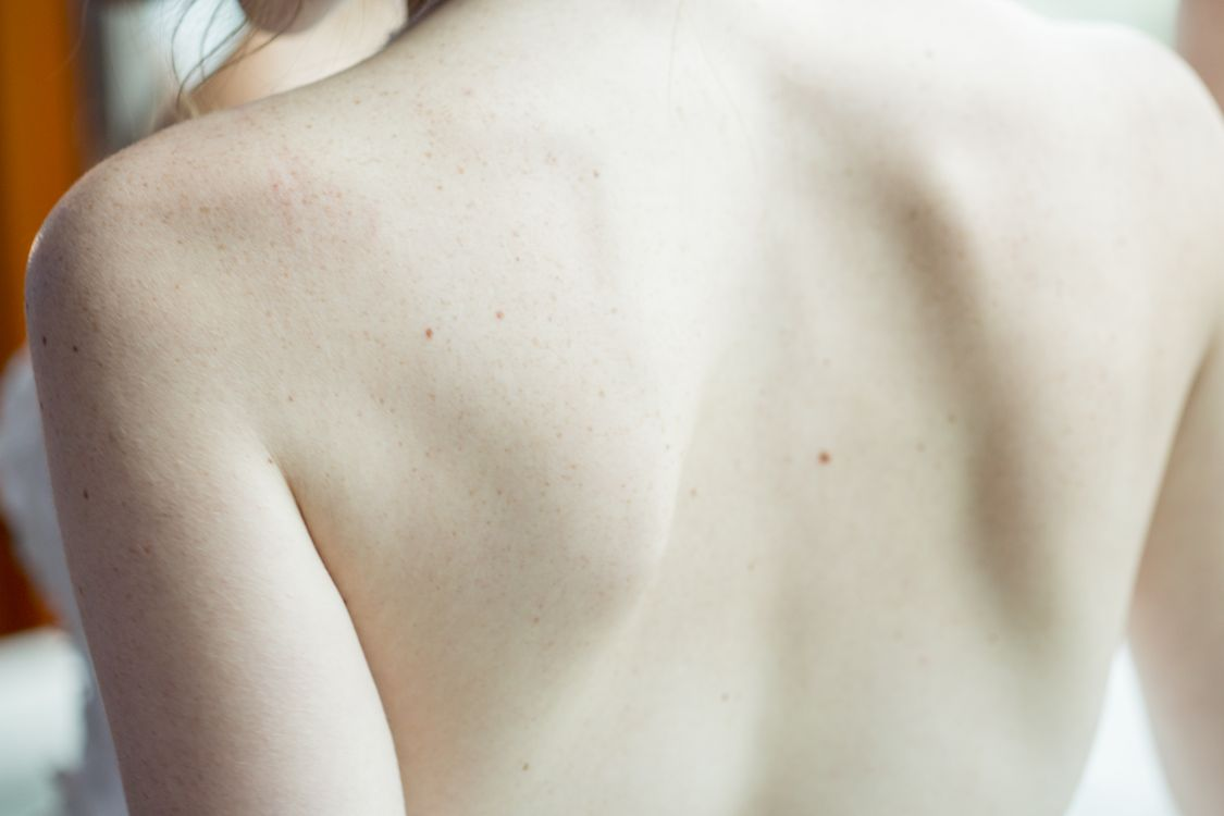 Healthy skin on a person's back represents skin renewal, repair, and regenerative signaling pathways.